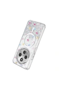 Xiaomi Redmi 14C Misk Simli Magsafe Kapak