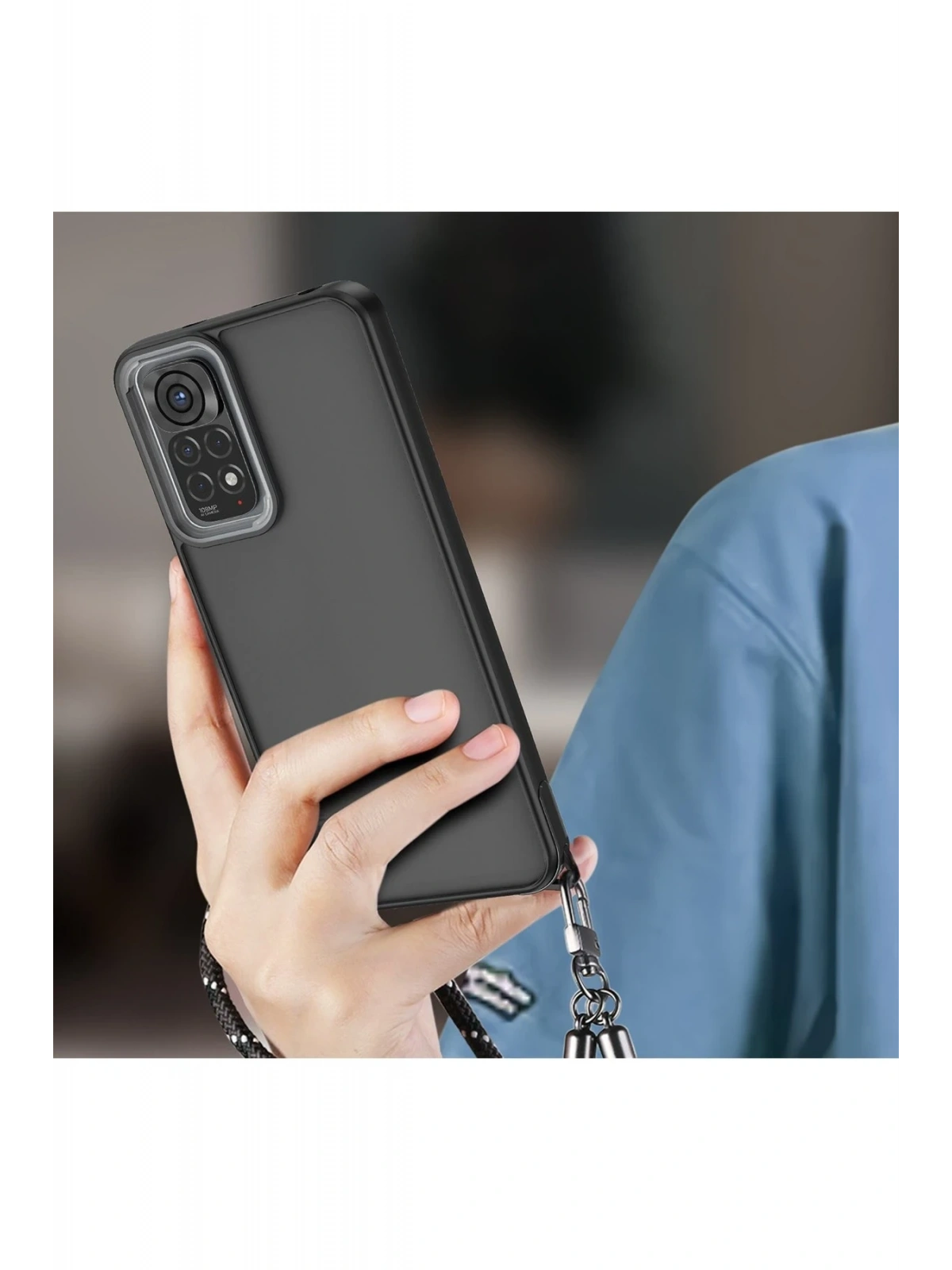 Newface Xiaomi Redmi Note 11 Kılıf Elegant Kapak - Pudra