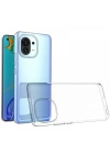 Newface Xiaomi Mi 11 Kılıf Lüx Şeffaf Silikon