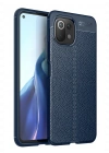 Newface Xiaomi Mİ 11 Lite Kılıf Auto Focus Kapak - Lacivert