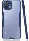 Newface Xiaomi Mİ 11 Lite Kılıf Platin Silikon - Lacivert