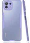 Newface Xiaomi Mİ 11 Lite Kılıf Platin Silikon - Lila