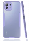 Newface Xiaomi Mİ 11 Lite Kılıf Platin Silikon - Lila