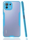 Newface Xiaomi Mİ 11 Lite Kılıf Platin Silikon - Mavi