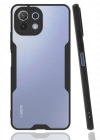 Newface Xiaomi Mİ 11 Lite Kılıf Platin Silikon - Siyah