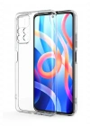 Newface Xiaomi Poco M4 Pro 4G Kılıf Lüx Şeffaf Silikon
