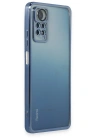 Newface Xiaomi Redmi Note 11 Pro Kılıf Razer Lensli Silikon - Açık Mavi