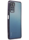 Newface Xiaomi Redmi Note 11 Pro Kılıf Razer Lensli Silikon - Mor