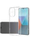 Newface Xiaomi Redmi Note 13 Pro Plus Kılıf Lüx Şeffaf Silikon