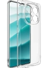 Newface Xiaomi Redmi Note 14 Pro Plus Kılıf Lüx Şeffaf Silikon