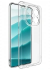 Newface Xiaomi Redmi Note 14 Pro Plus Kılıf Lüx Şeffaf Silikon