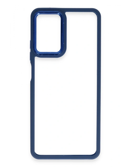 Newface Realme 10 Pro 5G Kılıf Dora Kapak - Mavi