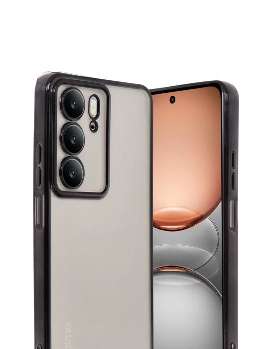 Newface Realme C75 4G Kılıf Razer Lensli Silikon - Siyah