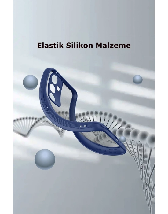 Newface Samsung Galaxy A24 4G Kılıf Platin Silikon - Sarı