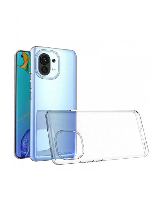 Newface Xiaomi Mi 11 Kılıf Lüx Şeffaf Silikon