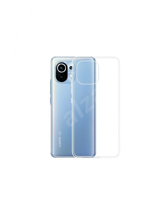 Newface Xiaomi Mi 11 Kılıf Lüx Şeffaf Silikon