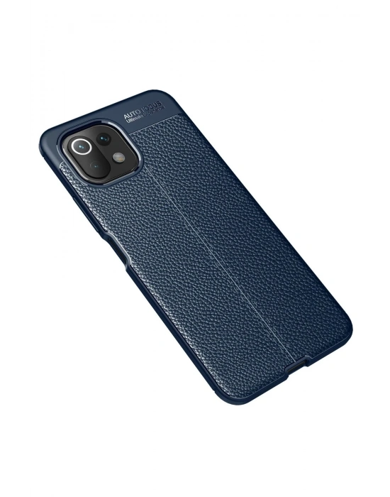 Newface Xiaomi Mİ 11 Lite Kılıf Auto Focus Kapak - Lacivert