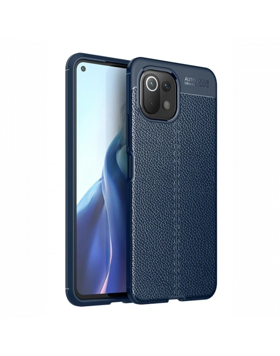 Newface Xiaomi Mİ 11 Lite Kılıf Auto Focus Kapak - Lacivert