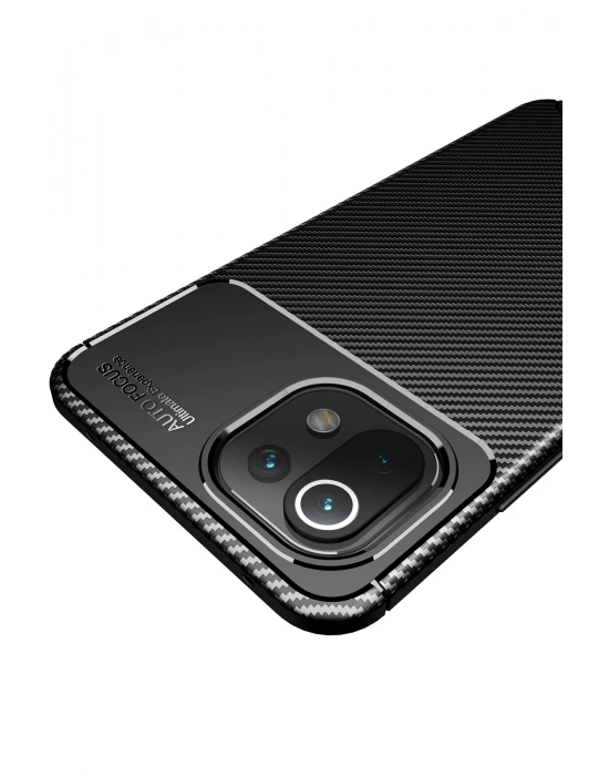 Newface Xiaomi Mİ 11 Lite Kılıf Auto Focus Karbon Kapak - Kahverengi