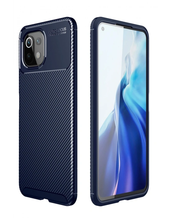 Newface Xiaomi Mİ 11 Lite Kılıf Auto Focus Karbon Kapak - Lacivert
