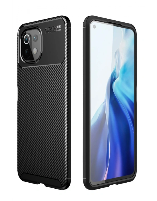 Newface Xiaomi Mİ 11 Lite Kılıf Auto Focus Karbon Kapak - Siyah