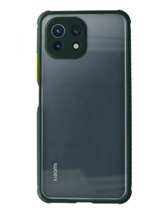 Newface Xiaomi Mİ 11 Lite Kılıf Miami Şeffaf Silikon - Koyu Yeşil