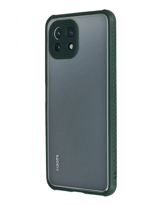 Newface Xiaomi Mİ 11 Lite Kılıf Miami Şeffaf Silikon - Koyu Yeşil