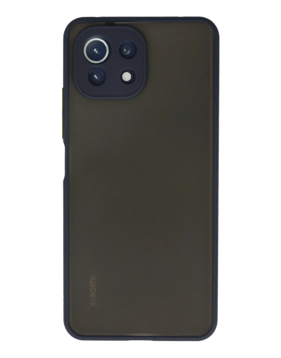 Newface Xiaomi Mİ 11 Lite Kılıf Montreal Silikon Kapak - Lacivert