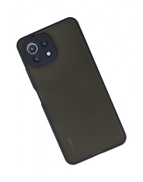 Newface Xiaomi Mİ 11 Lite Kılıf Montreal Silikon Kapak - Lacivert
