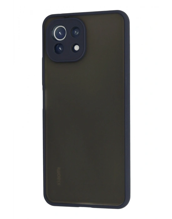 Newface Xiaomi Mİ 11 Lite Kılıf Montreal Silikon Kapak - Lacivert