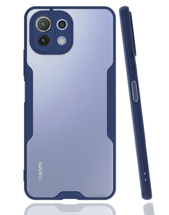Newface Xiaomi Mİ 11 Lite Kılıf Platin Silikon - Lacivert