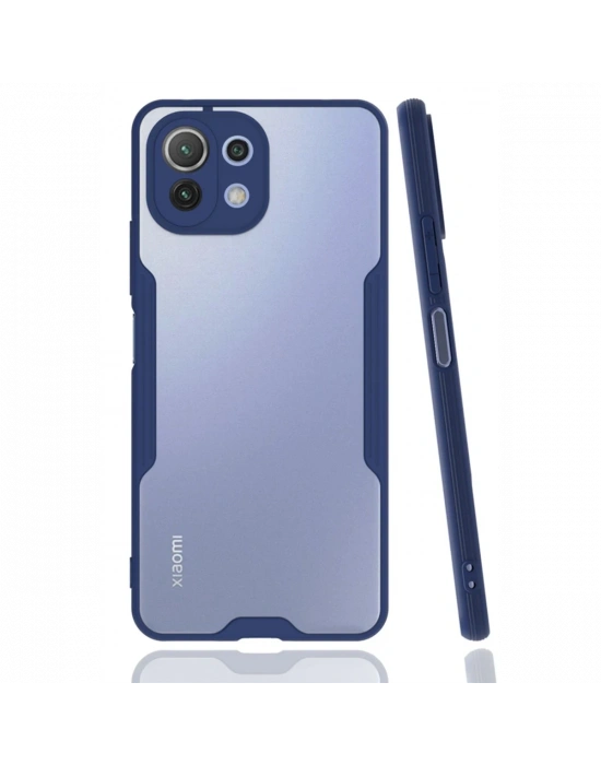 Newface Xiaomi Mİ 11 Lite Kılıf Platin Silikon - Lacivert