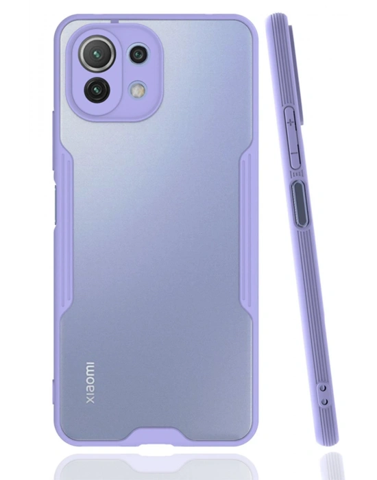 Newface Xiaomi Mİ 11 Lite Kılıf Platin Silikon - Lila
