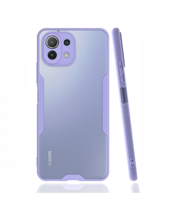 Newface Xiaomi Mİ 11 Lite Kılıf Platin Silikon - Lila