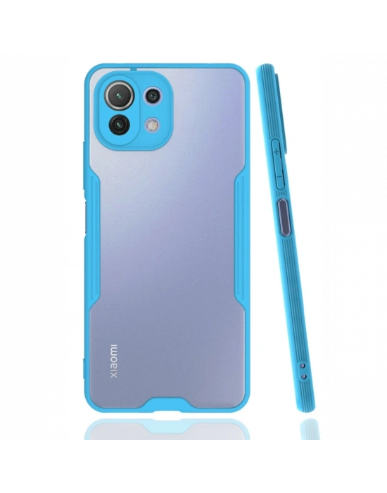 Newface Xiaomi Mİ 11 Lite Kılıf Platin Silikon - Mavi