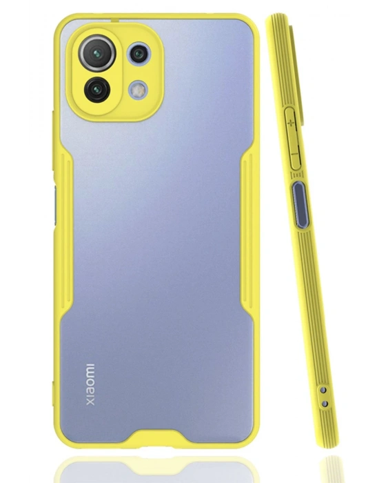 Newface Xiaomi Mİ 11 Lite Kılıf Platin Silikon - Sarı
