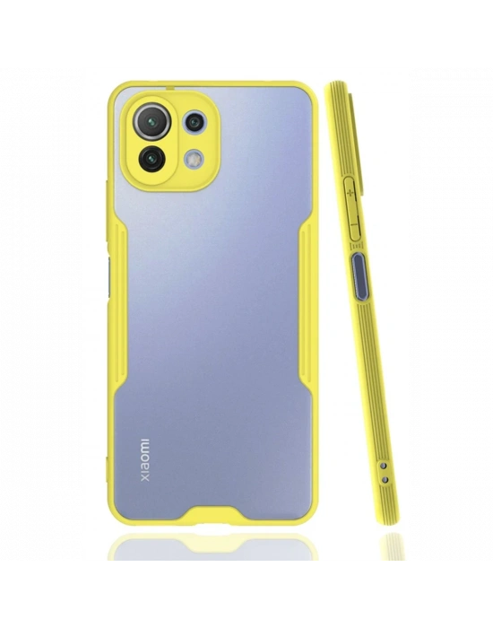 Newface Xiaomi Mİ 11 Lite Kılıf Platin Silikon - Sarı