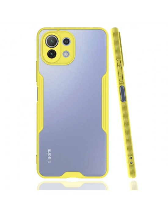 Newface Xiaomi Mİ 11 Lite Kılıf Platin Silikon - Sarı