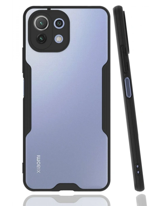 Newface Xiaomi Mİ 11 Lite Kılıf Platin Silikon - Siyah