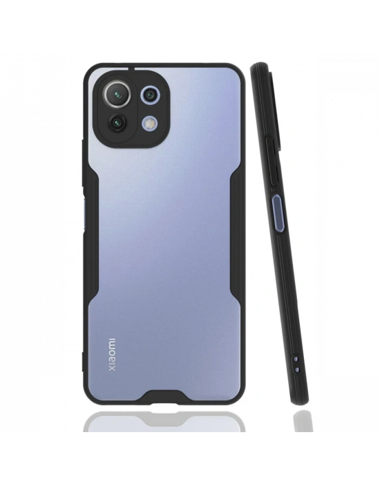 Newface Xiaomi Mİ 11 Lite Kılıf Platin Silikon - Siyah