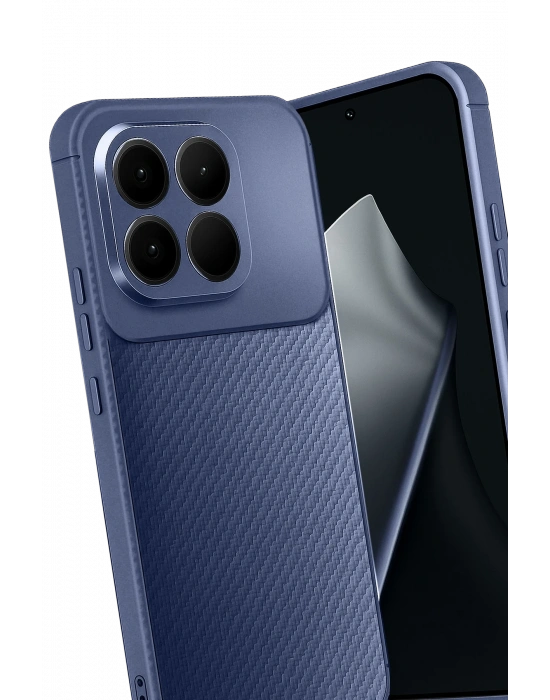 Newface Xiaomi Mi 15T Auto Focus Karbon Kapak - Lacivert