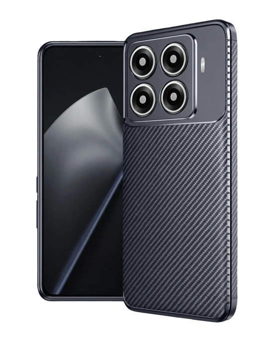 Newface Xiaomi Mi 15T Pro Auto Focus Karbon Kapak - Lacivert