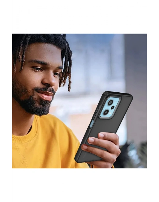 Newface Xiaomi Redmi 13 4G Kılıf Elegant Kapak - Pudra