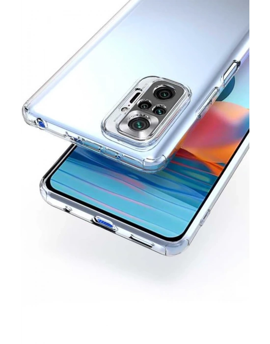 Newface Xiaomi Redmi Note 10 5G Kılıf Lüx Şeffaf Silikon