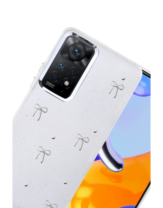 Newface Xiaomi Redmi Note 11 Pro Fiyonk Desenli Kapak - Desen 5