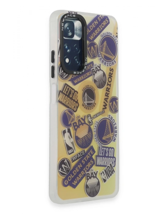 Newface Xiaomi Redmi Note 11 Pro Kılıf Estoril Desenli Kapak - Estoril - 13