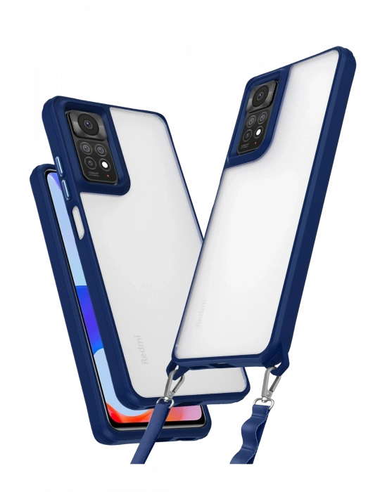 Newface Xiaomi Redmi Note 11 Pro Kılıf Penta Silikon Kılıf - Lacivert