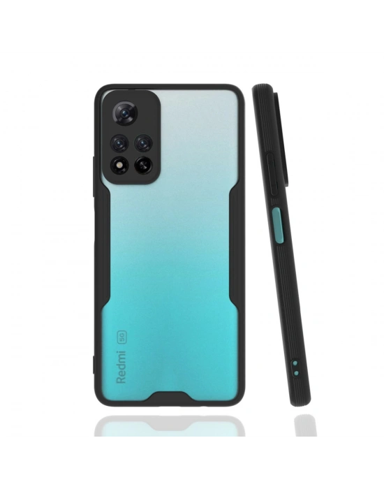 Newface Xiaomi Redmi Note 11 Pro Plus 5G Kılıf Platin Silikon - Siyah