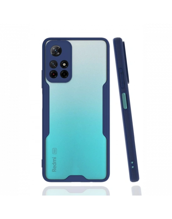 Newface Xiaomi Redmi Note 11T Kılıf Platin Silikon - Lacivert