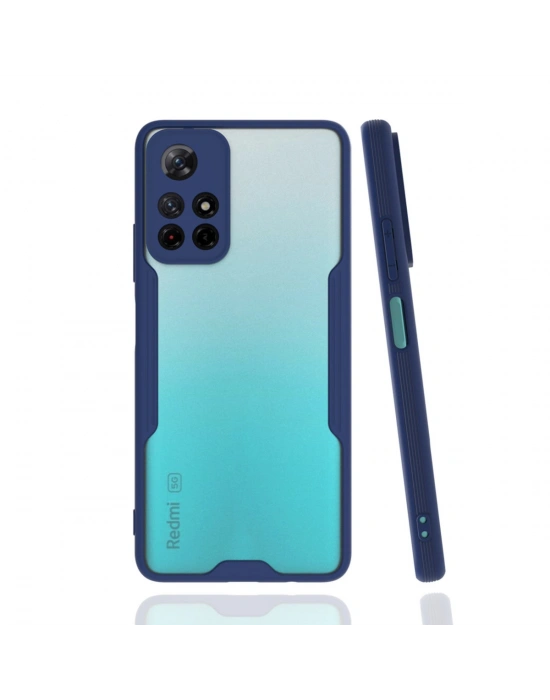 Newface Xiaomi Redmi Note 11T Kılıf Platin Silikon - Lacivert